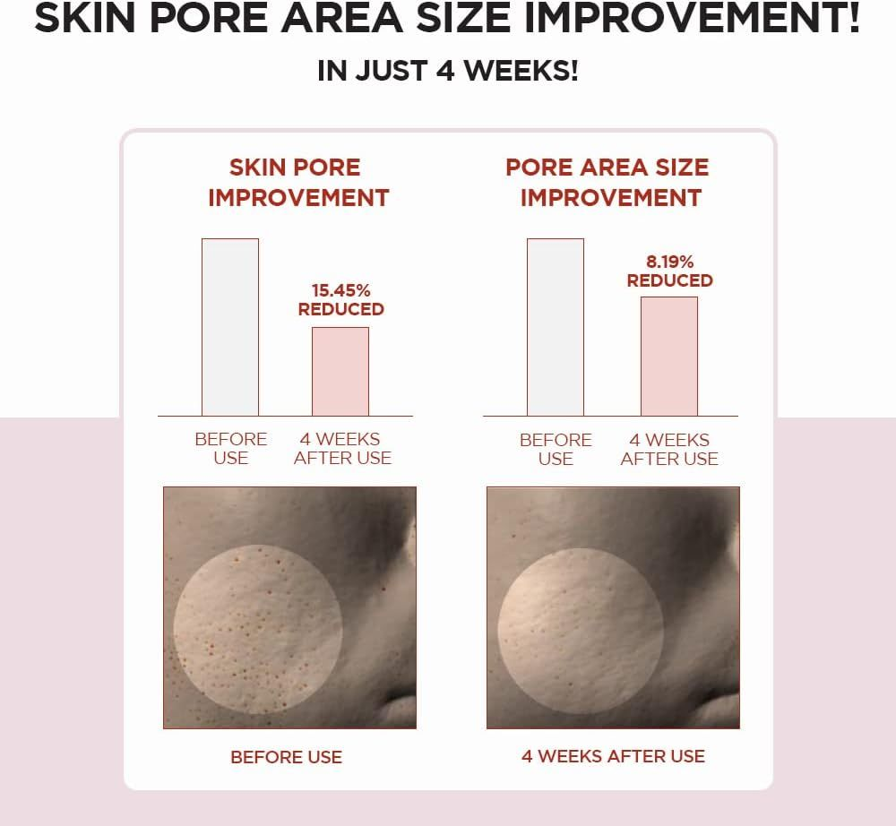 SKIN1004 Poremizing Clear Toner-Exfoliating, Sebum Control & Pore Tightening